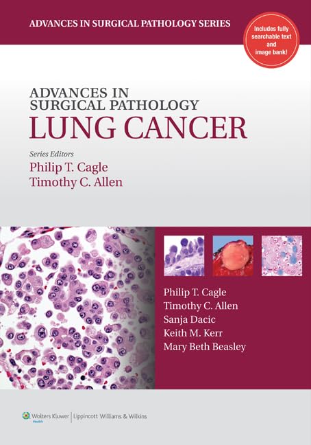 Advances in Surgical Pathology: Lung Cancer (Advances in Surgical Pathology Series)