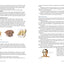 Illustrated Moxibustion Therapy: A Natural Way of Prevention and Treatment through Traditional Chinese Medicine