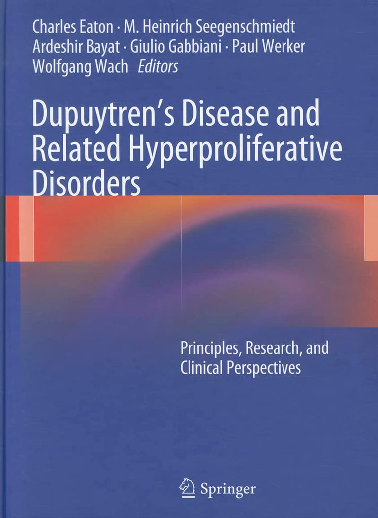 Dupuytrens Disease and Related Hyperproliferative Disorders: Principles, Research, and Clinical Perspectives
