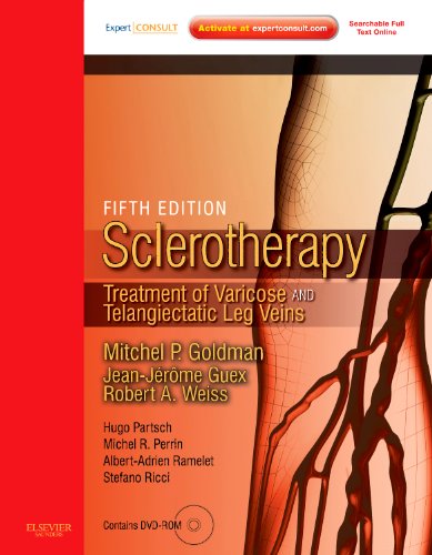 Sclerotherapy Expert Consult - Online and Print: Treatment of Varicose and Telangiectatic Leg Veins, Text with DVD