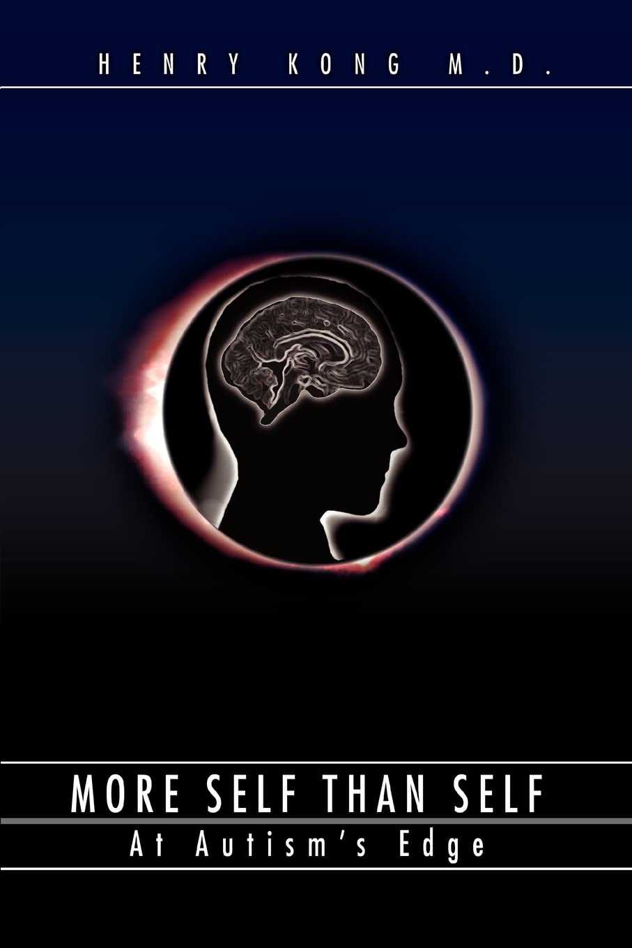 More Self than Self: At Autisms Edge