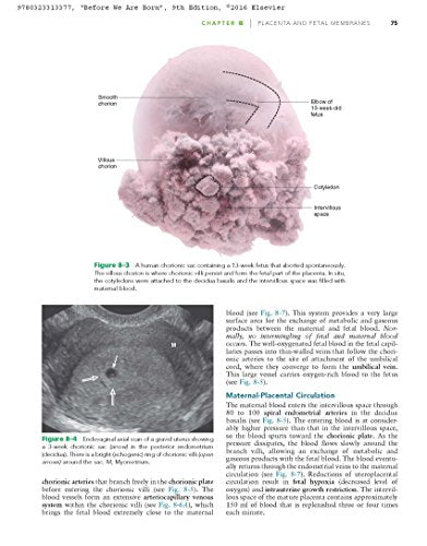Before We Are Born: Essentials of Embryology and Birth Defects