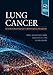 Lung Cancer: An Evidence-Based Approach to Multidisciplinary Management