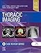Thoracic Imaging: Case Review