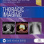Thoracic Imaging: Case Review
