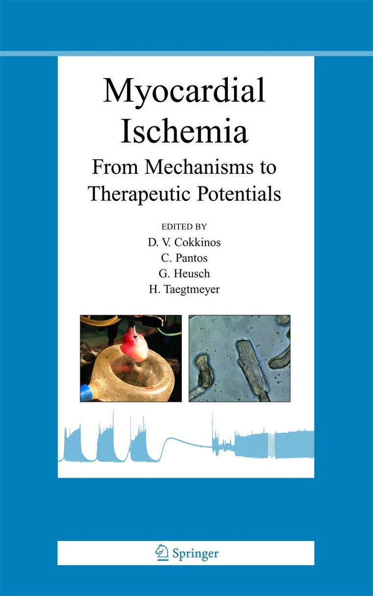 Myocardial Ischemia: From Mechanisms to Therapeutic Potentials (Basic Science for the Cardiologist, 21)