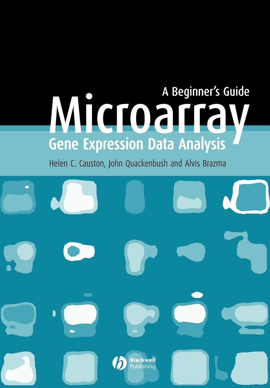 Microarray Gene Expression Data Analysis: A Beginner's Guide