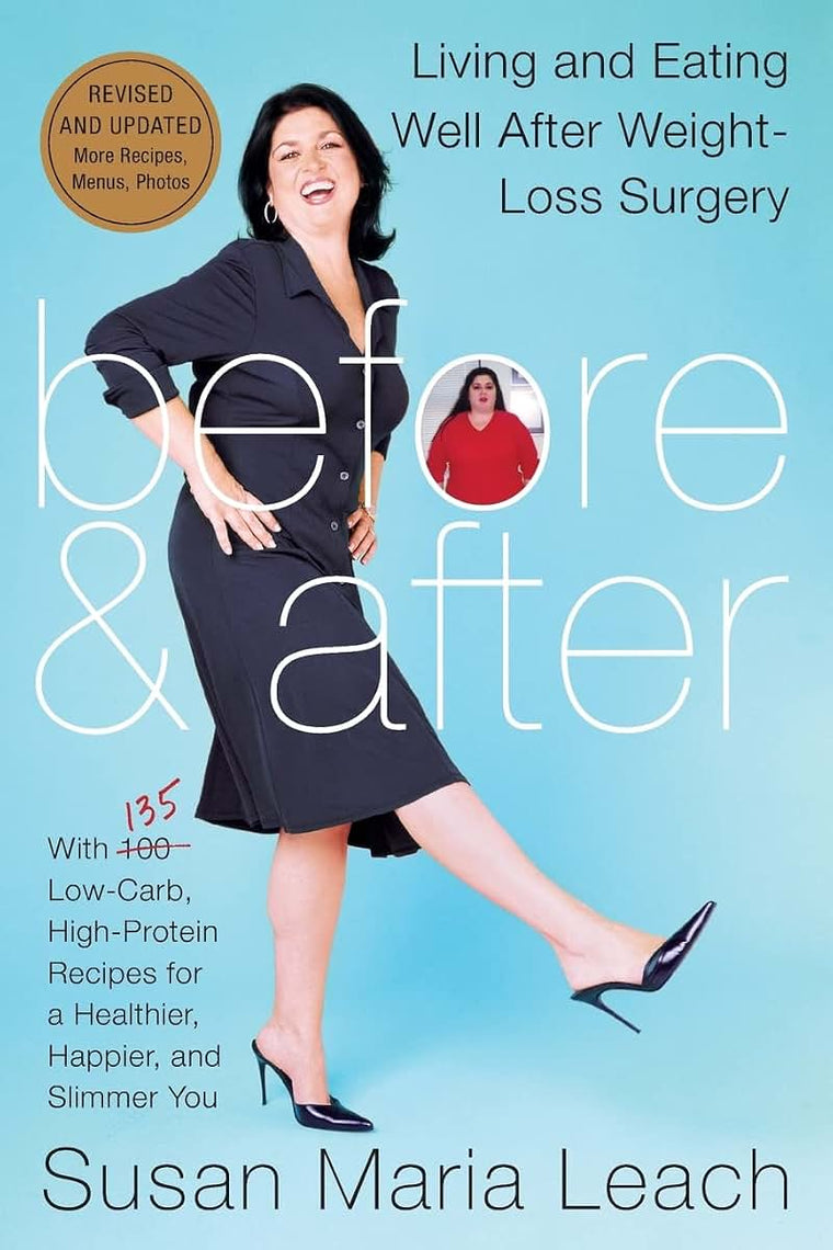 Before & After, Revised Edition: Living and Eating Well After Weight-Loss Surgery
