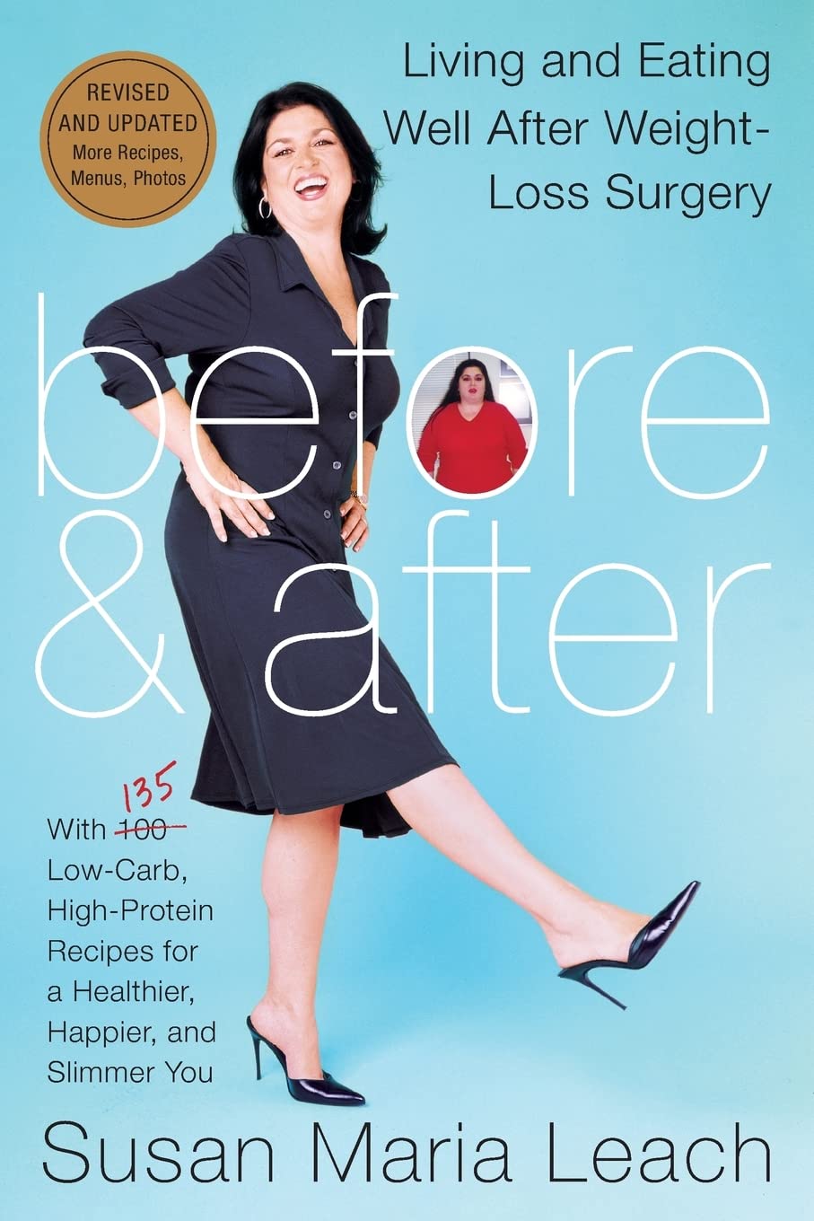 Before & After, Revised Edition: Living and Eating Well After Weight-Loss Surgery
