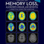 Memory Loss, Alzheimer's Disease and Dementia: A Practical Guide for Clinicians