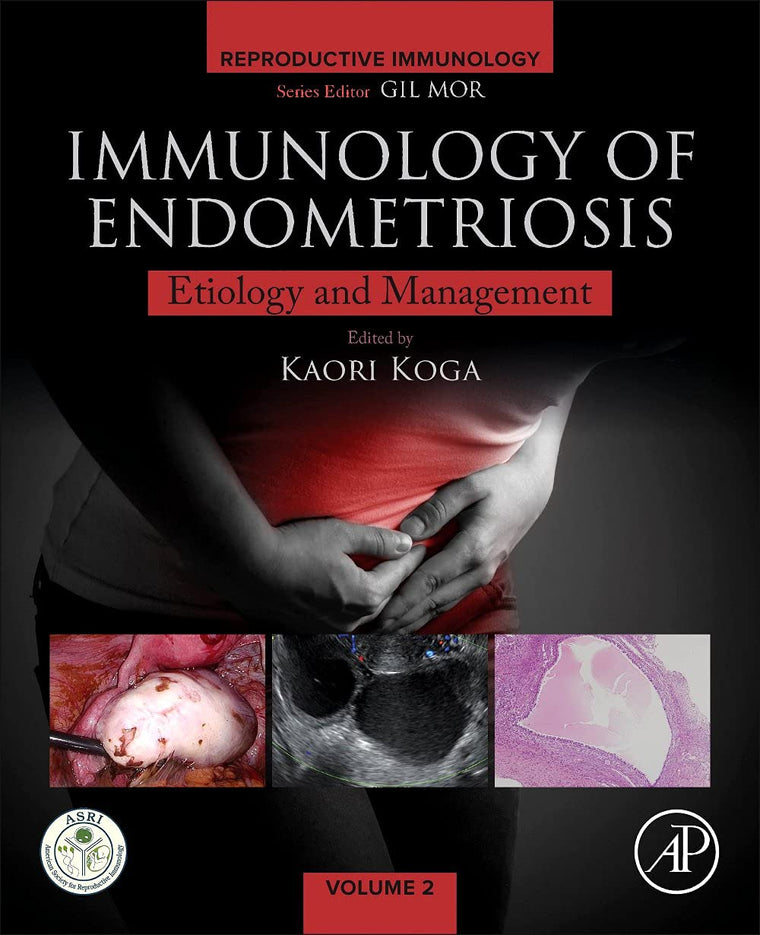 Immunology of Endometriosis: Pathogenesis and Management (Reproductive Immunology)