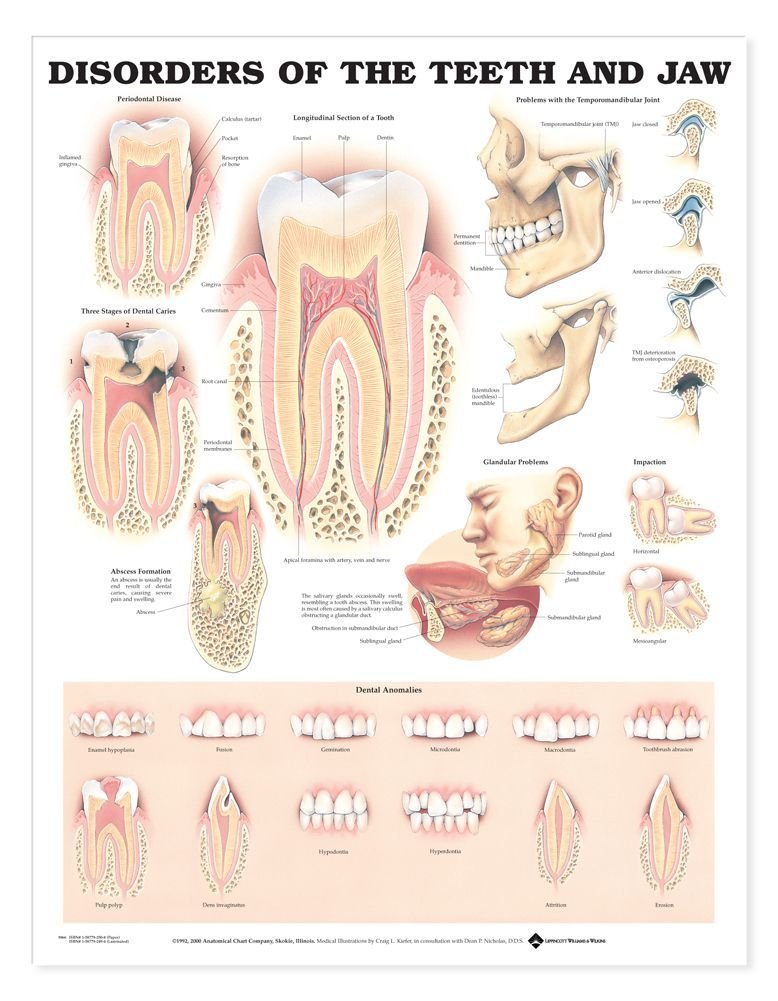 Disorders of the Teeth and Jaw Anatomical Chart by Anatomica
