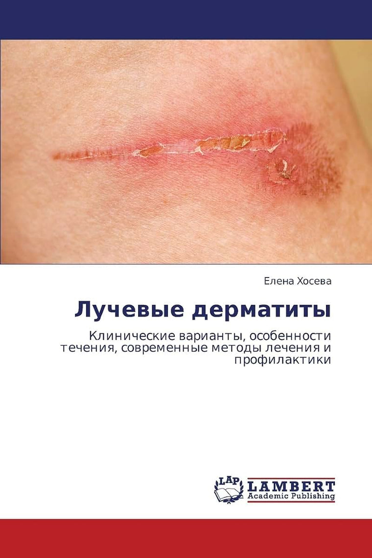 Luchevye dermatity: Klinicheskie varianty, osobennosti techeniya, sovremennye metody lecheniya i profilaktiki (Russian Edition)