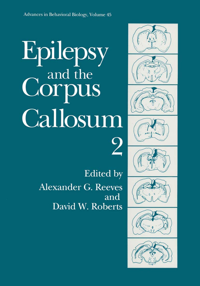Epilepsy & the Corpus Callosum II