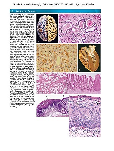 Rapid Review Pathology: With STUDENT CONSULT Online Access
