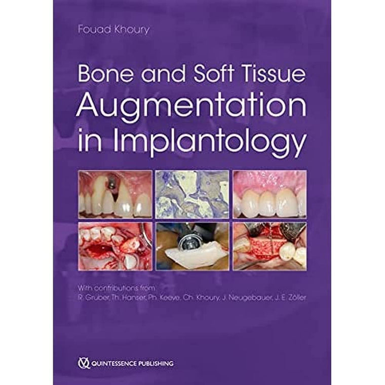 Bone and Soft Tissue Augmentation in Implantology