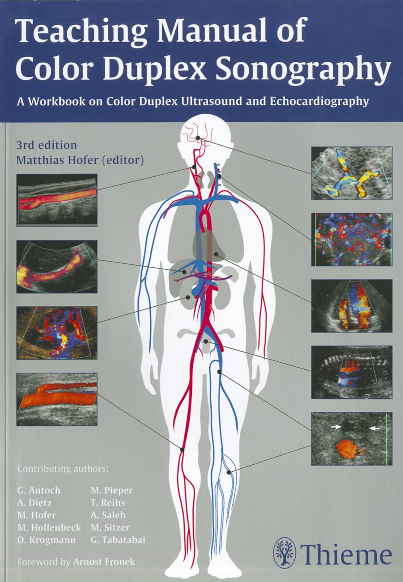 Teaching Manual of Color Duplex Sonography