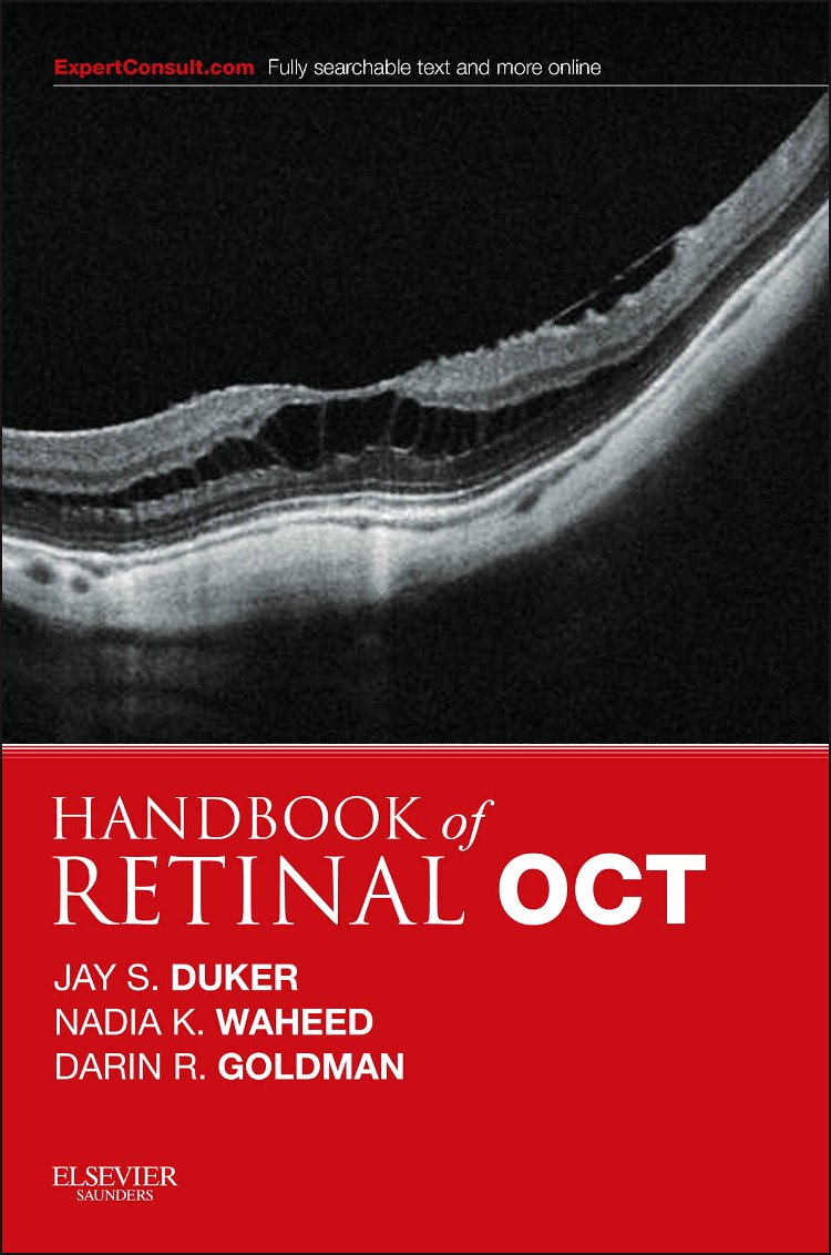 Handbook of Retinal OCT: Optical Coherence Tomography, 1e by
