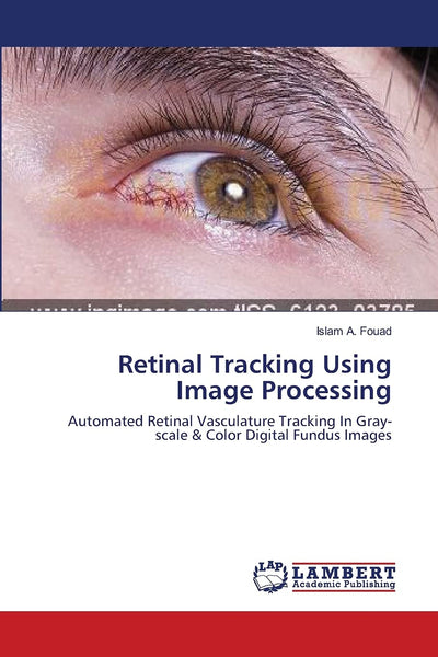 Retinal Tracking Using Image Processing: Automated Retinal Vasculature Tracking In Gray-scale & Color Digital Fundus Images