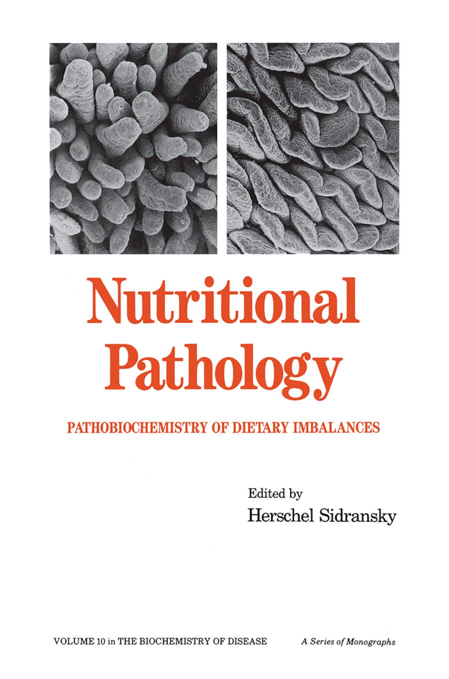 Nutritional Pathology: Pathobiochemistry of Dietary Imbalances (Biochemistry of Disease)