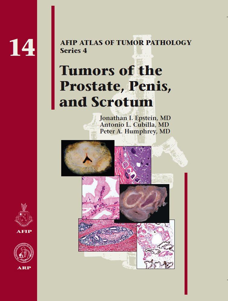 Tumors of the Prostate Gland, Seminal Vesicles, Penis, and Scrotum: 14 (AFIP Atlas of Tumor Pathology: Series 4)