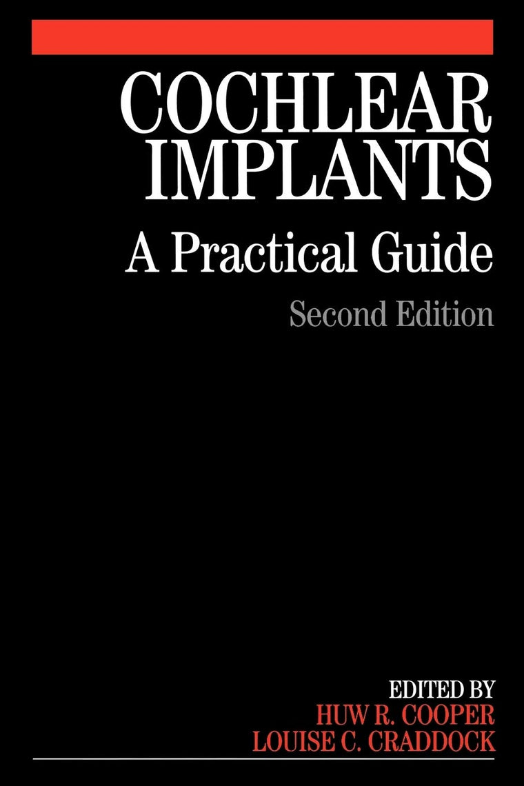 Cochlear Implants: A Practical Guide