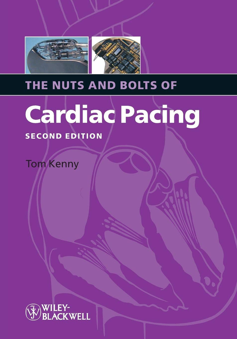 The Nuts and Bolts of Cardiac Pacing