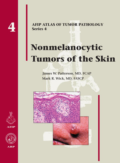 Nonmelanocytic Tumors of the Skin (Atlas of Tumor Pathology Series IV)