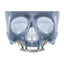 Remote Anchorage Solutions for Severe Maxillary Atrophy: Zygomatic Implants, Pterygoid Implants, Transnasal Implants, Piriform Rim Implants, Nasopalatine Implants, and Trans-Sinus Dental Implants