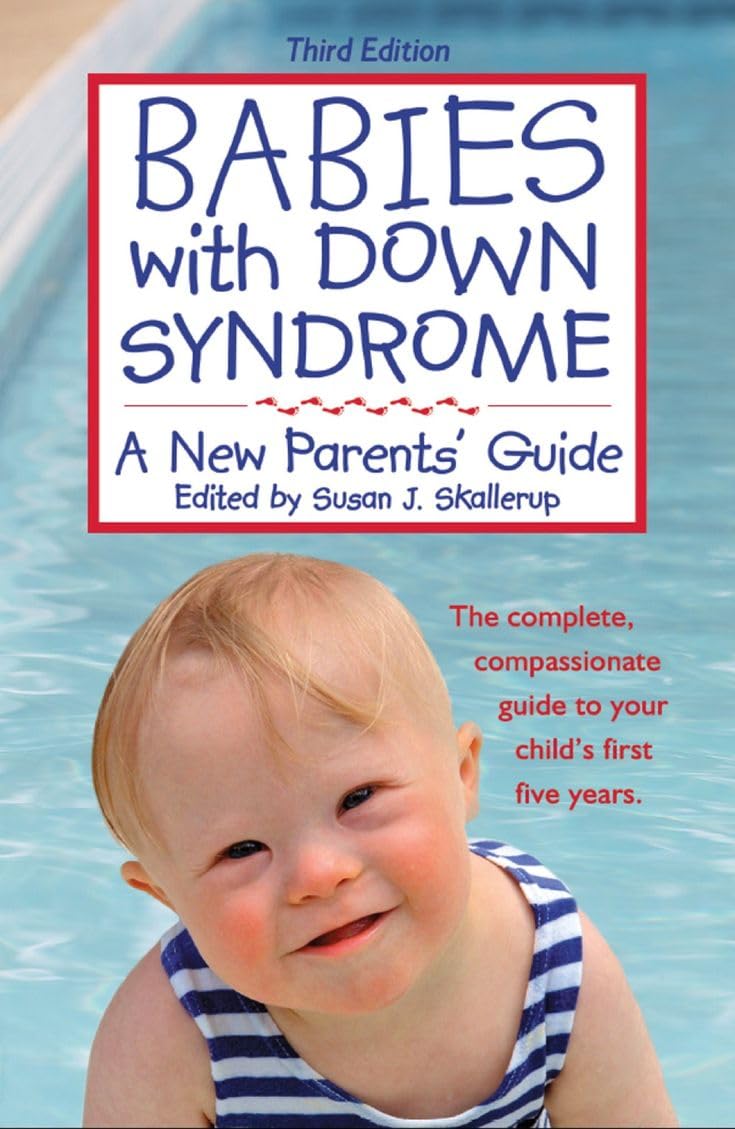 Babies With Down Syndrome: A New Parents' Guide