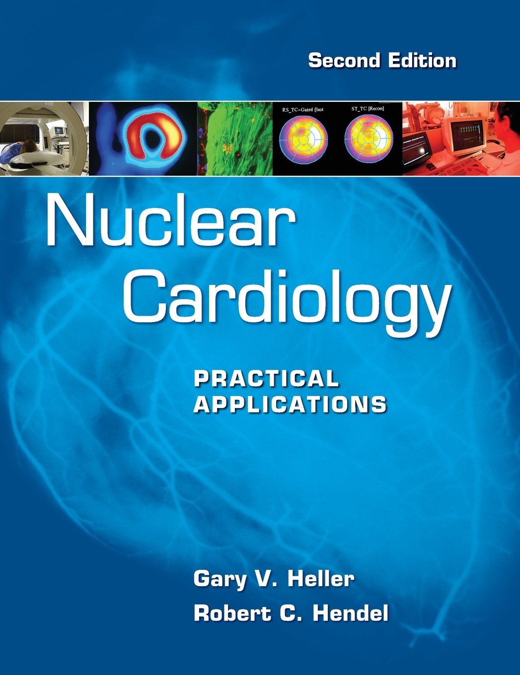 Nuclear Cardiology: Practical Applications, Second Edition