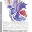 Boston Children's Hospital Cardiac ICU Manual For Bedside Providers - an illustrated handbook of congenital heart disease
