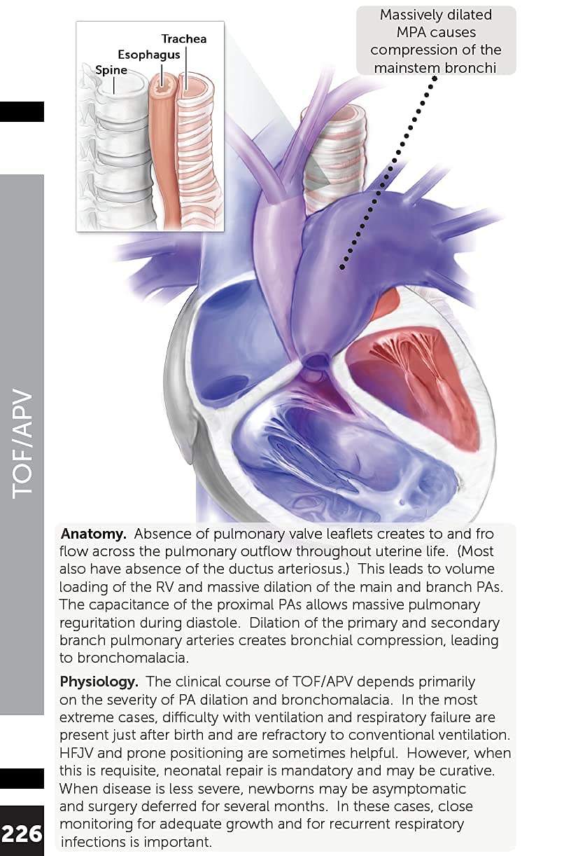 Boston Children's Hospital Cardiac ICU Manual For Bedside Providers - an illustrated handbook of congenital heart disease