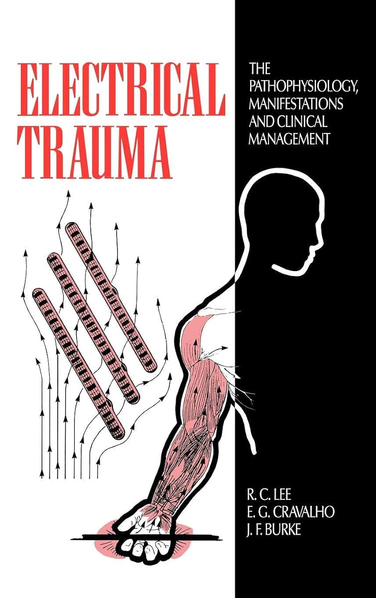 Electrical Trauma: The Pathophysiology, Manifestations and Clinical Management