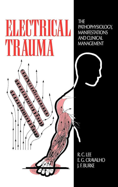 Electrical Trauma: The Pathophysiology, Manifestations and Clinical Management