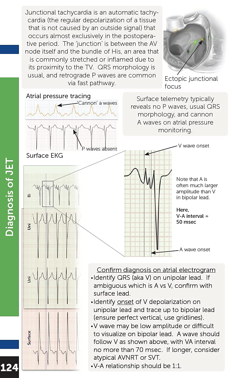 Boston Children's Hospital Cardiac ICU Manual For Bedside Providers - an illustrated handbook of congenital heart disease