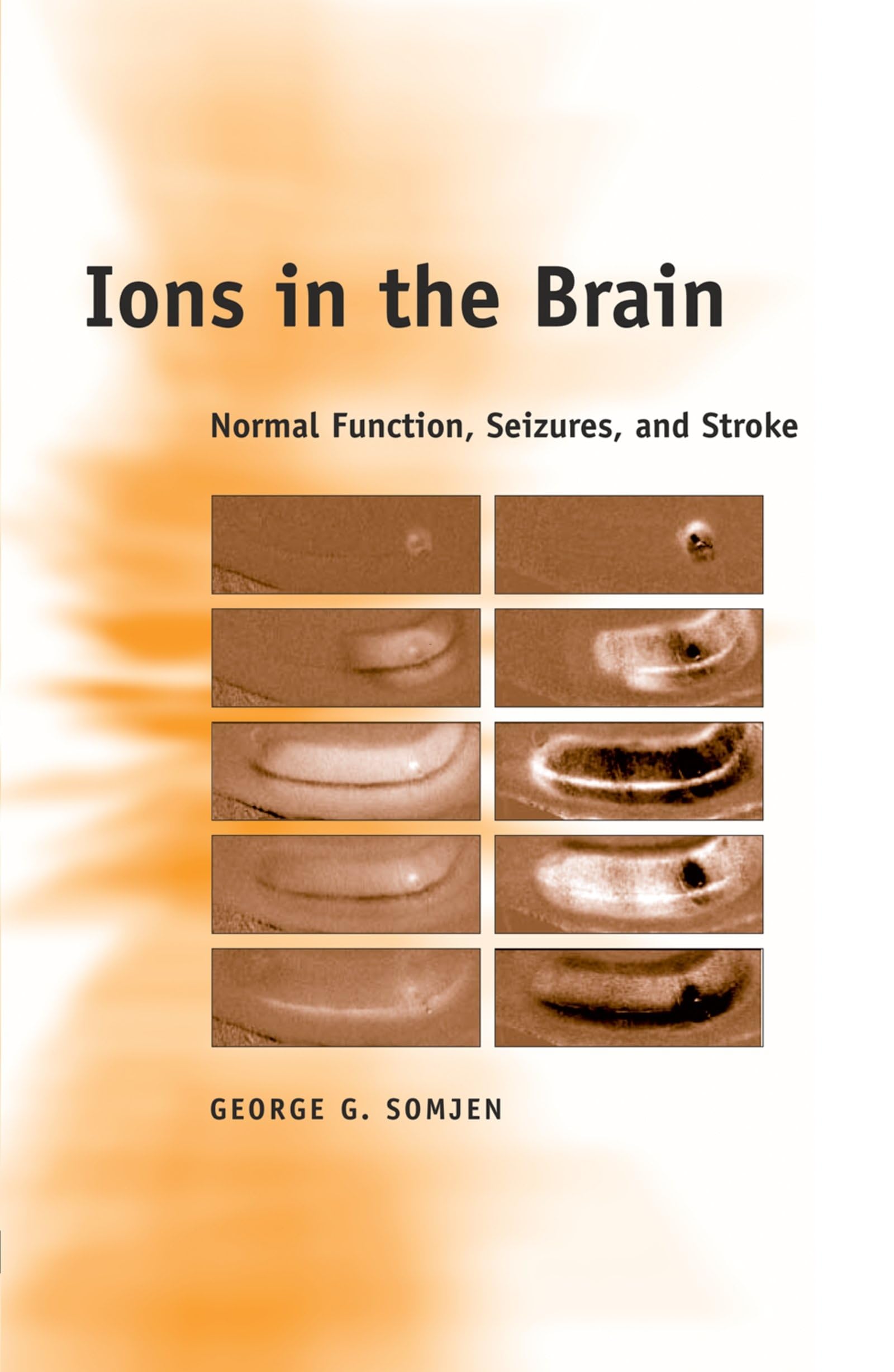 Ions in the Brain: Normal Function, Seizures, and Stroke