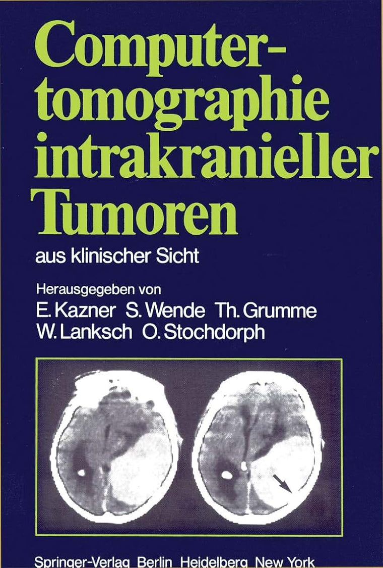 Computertomographie intrakranieller Tumoren aus klinischer Sicht (German Edition)