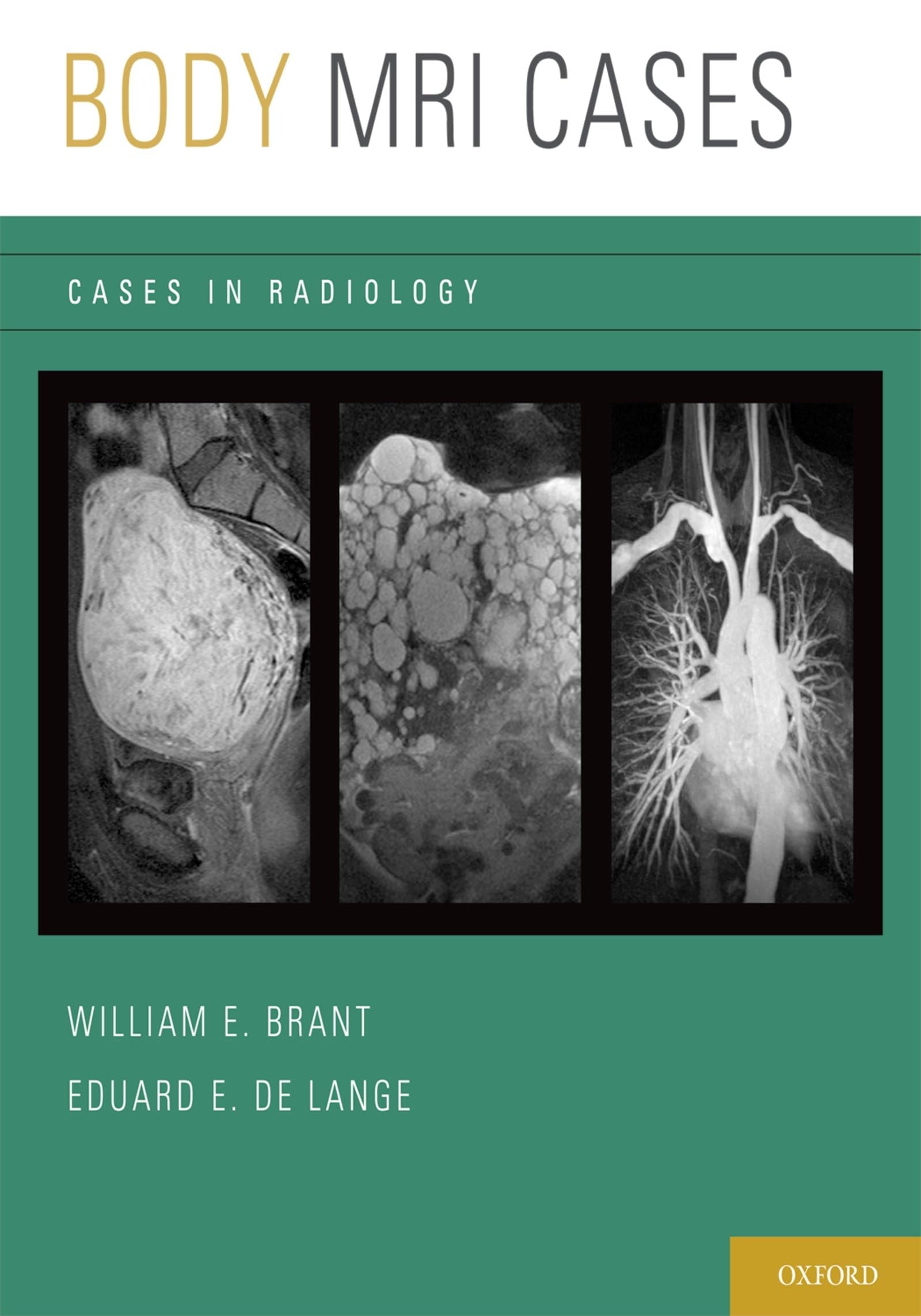 Body MRI Cases (Cases in Radiology)
