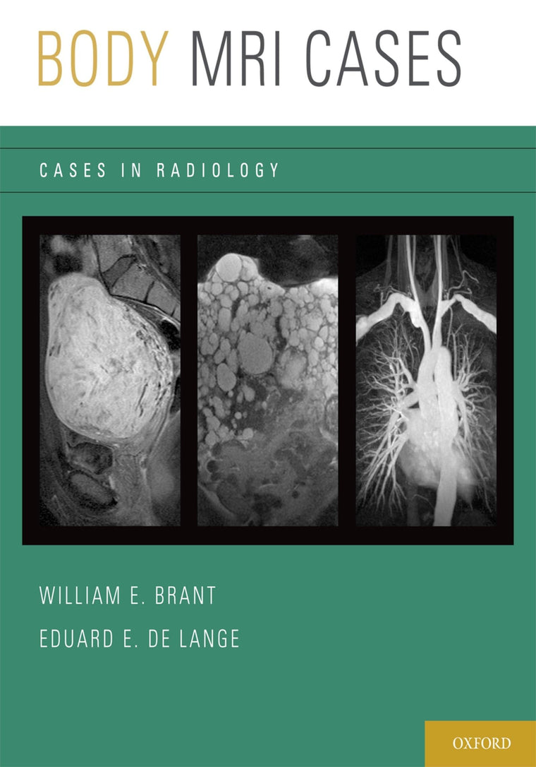 Body MRI Cases (Cases in Radiology)