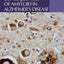 Intracellular Consequences of Amyloid in Alzheimer's Disease