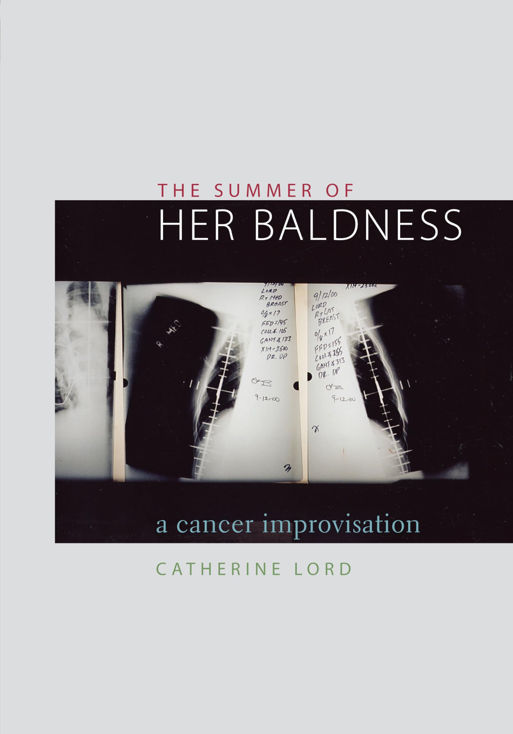 The Summer of Her Baldness: A Cancer Improvisation (Constructs Series)