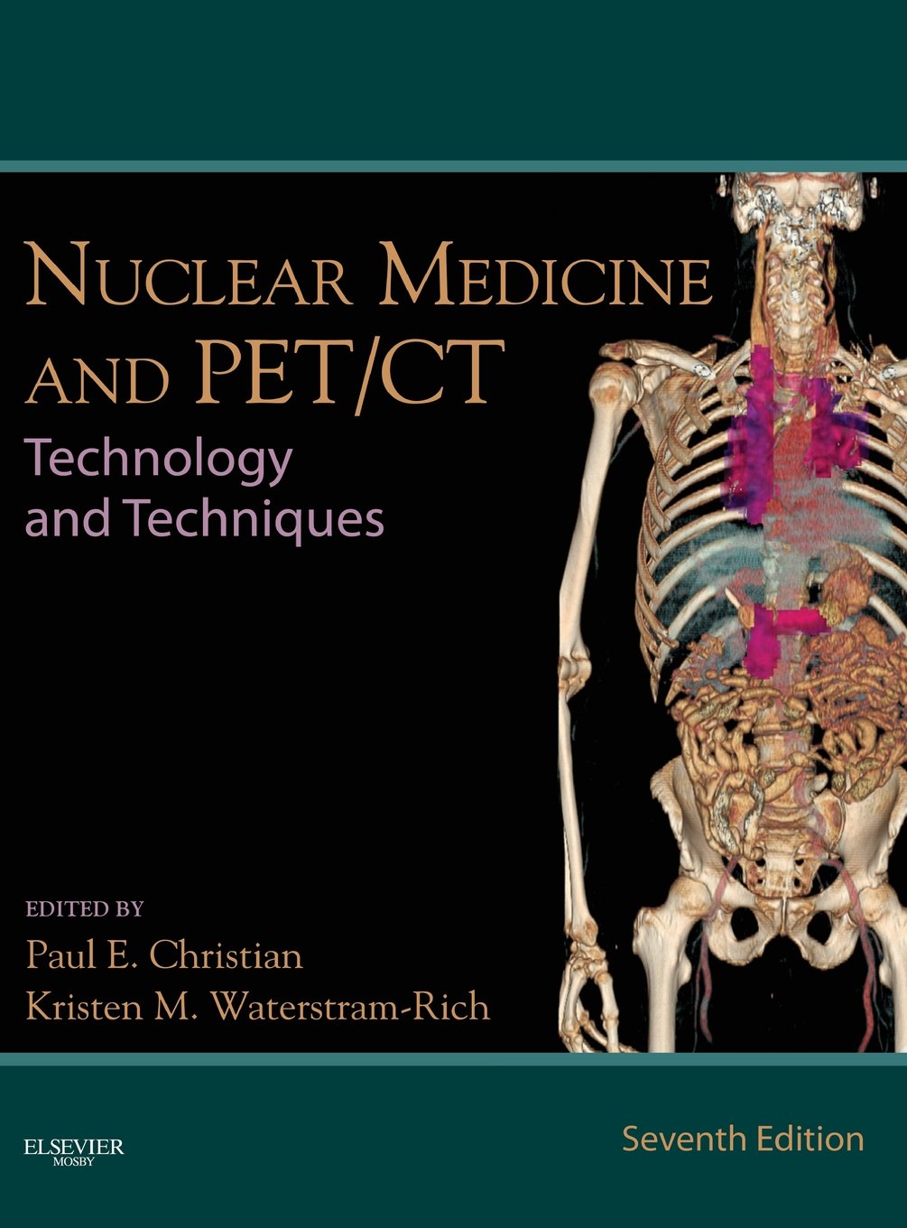 Nuclear Medicine and PET/CT: Technology and Techniques by Ch