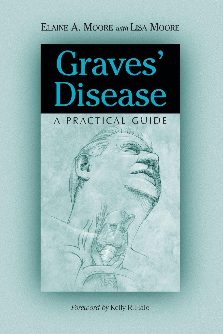 Graves' Disease: A Practical Guide (McFarland Health Topics)