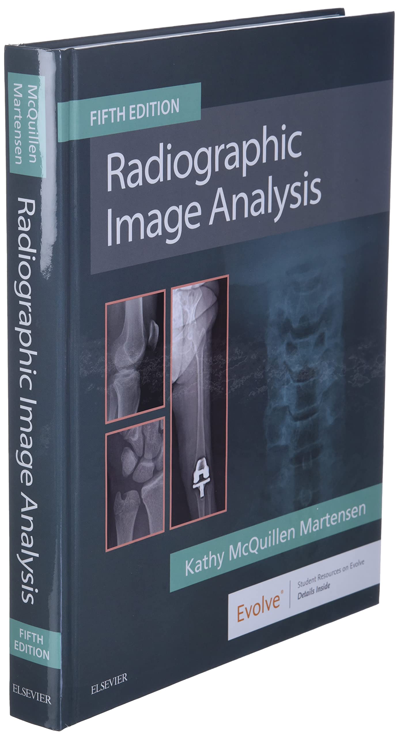 Radiographic Image Analysis by Martensen MA RT(R), Kathy McQ