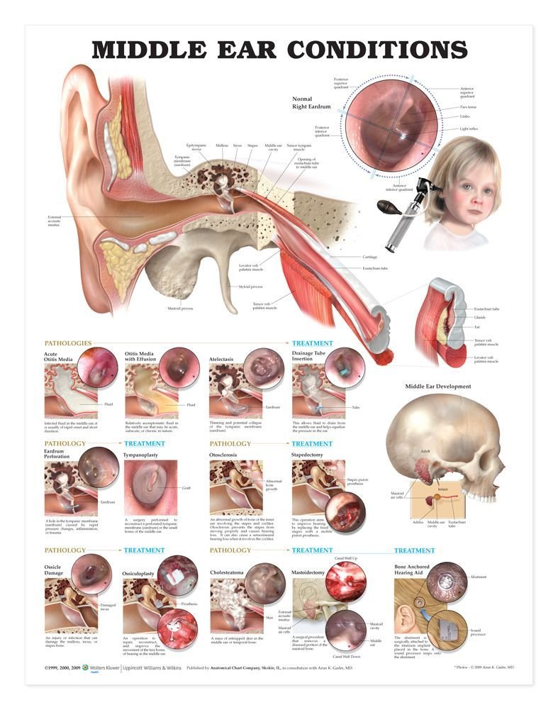Middle Ear Conditions Anatomical Chart by Anatomical Chart C