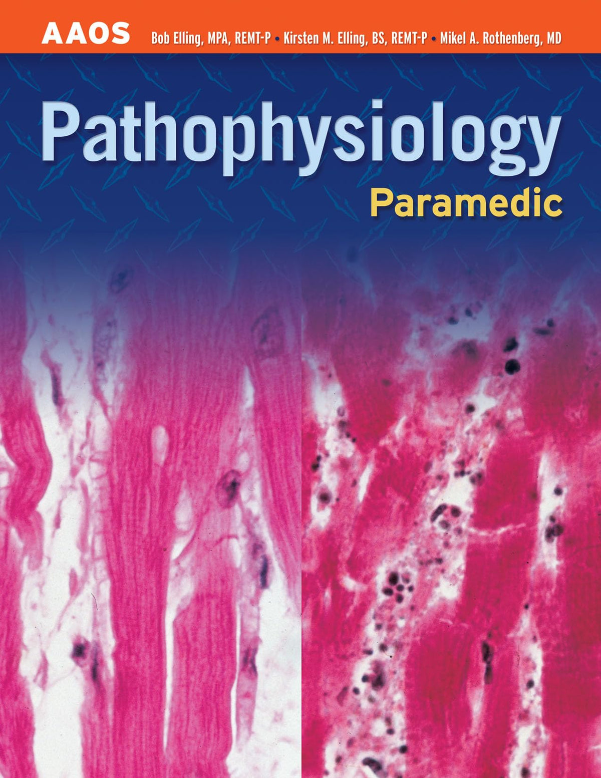 Paramedic: Pathophysiology: Pathophysiology (AAOS Paramedic)