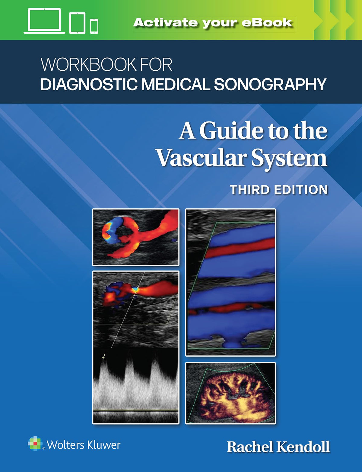 Workbook for Diagnostic Medical Sonography: The Vascular Systems (Lippincott Connect)