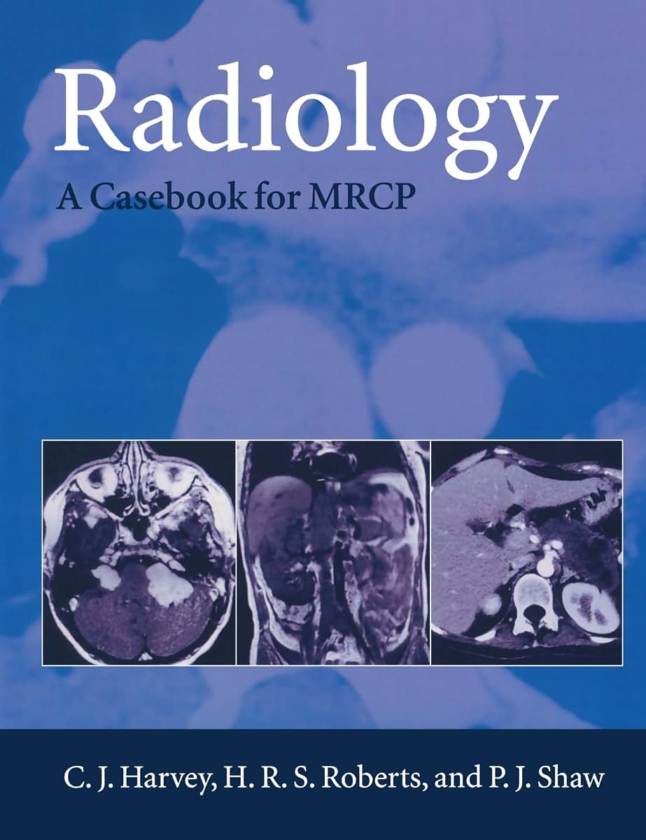 Radiology: A Casebook for M.R.C.P. (Oxford Medical Publications)