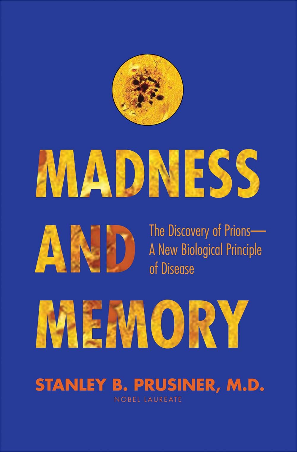 Madness and Memory: The Discovery of Prions--A New Biologica